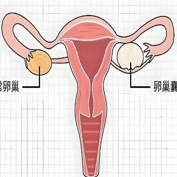 卵巢囊肿的症状表现具体指什么？泰安俪人医院来介绍