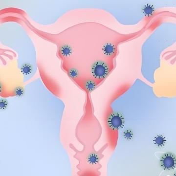 引发女性盆腔炎的几大原因是什么？