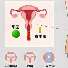 患有尿道炎的女性症状表现有哪些？