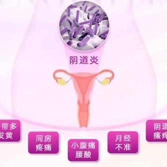 阴道炎的症状表现都有哪些？泰安俪人医院为您解答