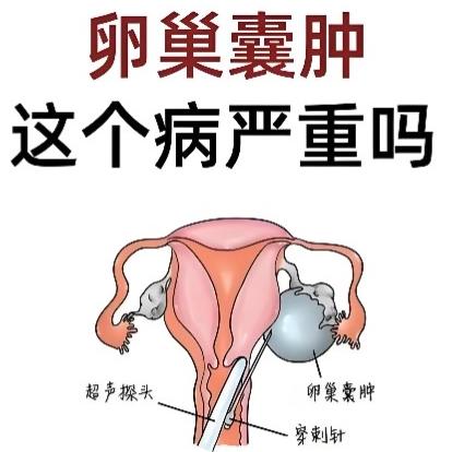 患有卵巢囊肿后要注意什么？这几点很关键