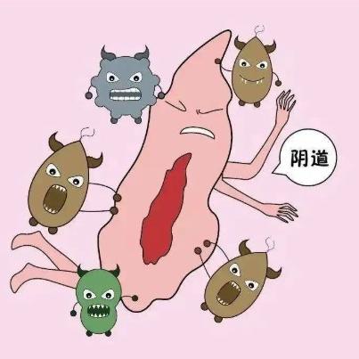 引发女性外阴瘙痒的原因具体有哪几个？