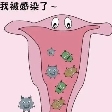 女性引发阴道炎的原因有哪几个？