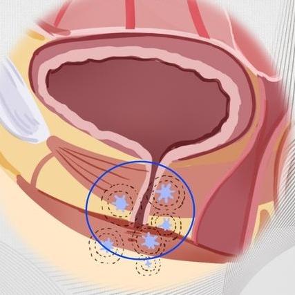 女性患有尿道炎后的症状表现是什么？