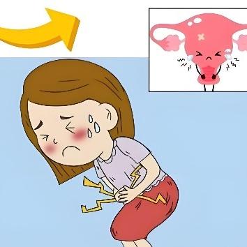 女性患有盆腔炎的原因都有哪些？这些全是出现的原因所在