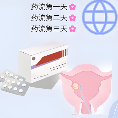 药物流产期间要注意哪些细节？