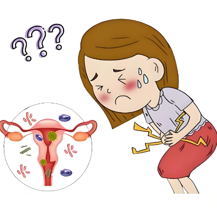 女性盆腔炎的出现和哪些因素有关？
