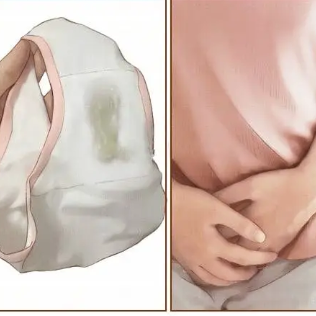 女性阴道炎为什么会反复出现呢？