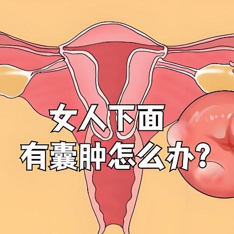 你了解子宫囊肿吗？这是什么情况引起的？