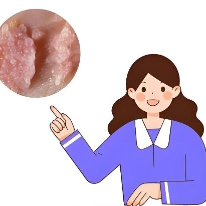 女性出现尿道炎的原因都有哪些？