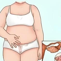 女性患有多囊卵巢综合症后都有哪些危害表现