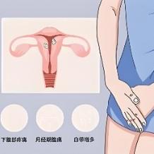 女性出现盆腔炎的原因是什么？