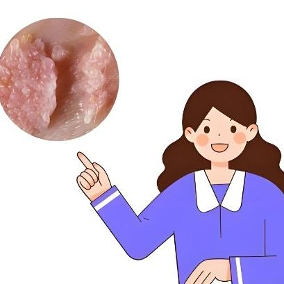 女性尿道炎的症状表现在哪几个方面？