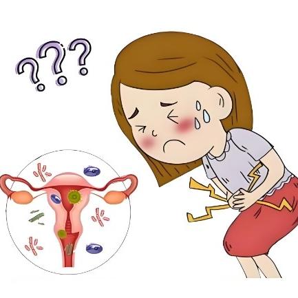 引发女性盆腔炎的几个原因是什么？