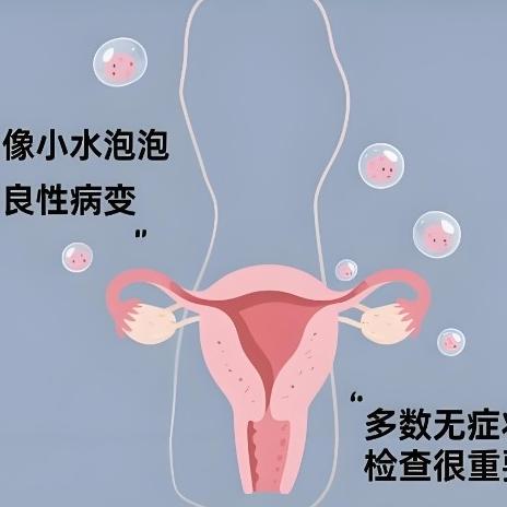 患有子宫囊肿后要注意哪些地方？