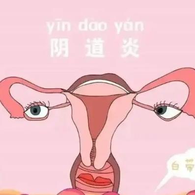 女性阴道炎的表现具体都有哪些？