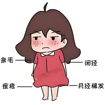 女性出现多个卵巢囊肿的原因解析