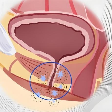泰安俪人医院谈女性患有尿道炎的症状表现