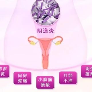 女性患有阴道炎后的症状表现都有哪些？