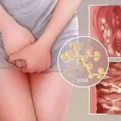 泰安俪人妇产医院讲述引发女性外阴瘙痒的原因是什么