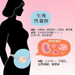 卵巢囊肿的症状表现具体指什么？