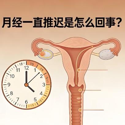 女性月经推迟的原因究竟有哪些？