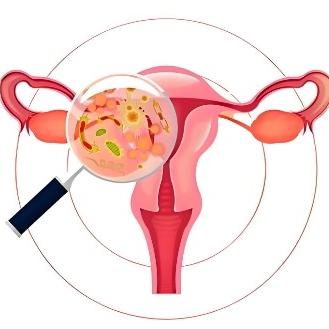 女性盆腔炎的症状表现是什么？