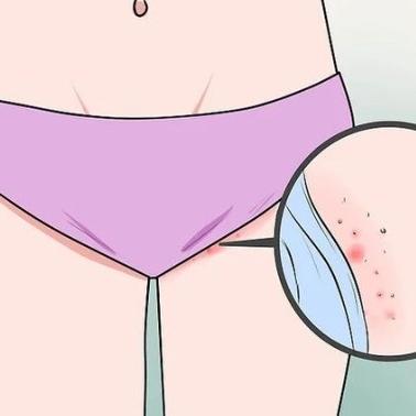 女性外阴瘙痒到底是怎么回事？