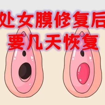 女性要做处女膜修补术的话要注意哪些细节