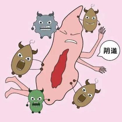 女性下面痒是怎么回事？接下来详细介绍下