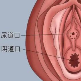 女性尿道炎的症状表现都有哪些？